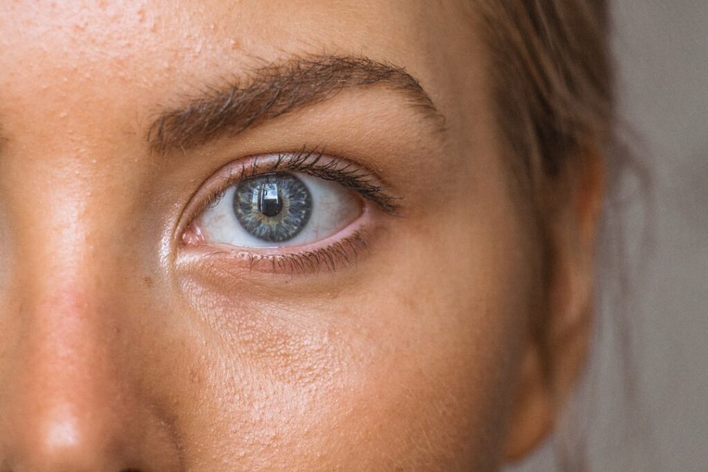 Photo Under Eye Fillers